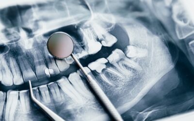 Herramientas de IA para Mejorar Procesos en Clínicas Dentales