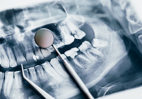 Herramientas de IA para Mejorar Procesos en Clínicas Dentales